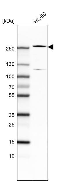 TET2 Antibody (CL6873) - Azide and BSA Free Western Blot: TET2 Antibody [NBP3-44224]
