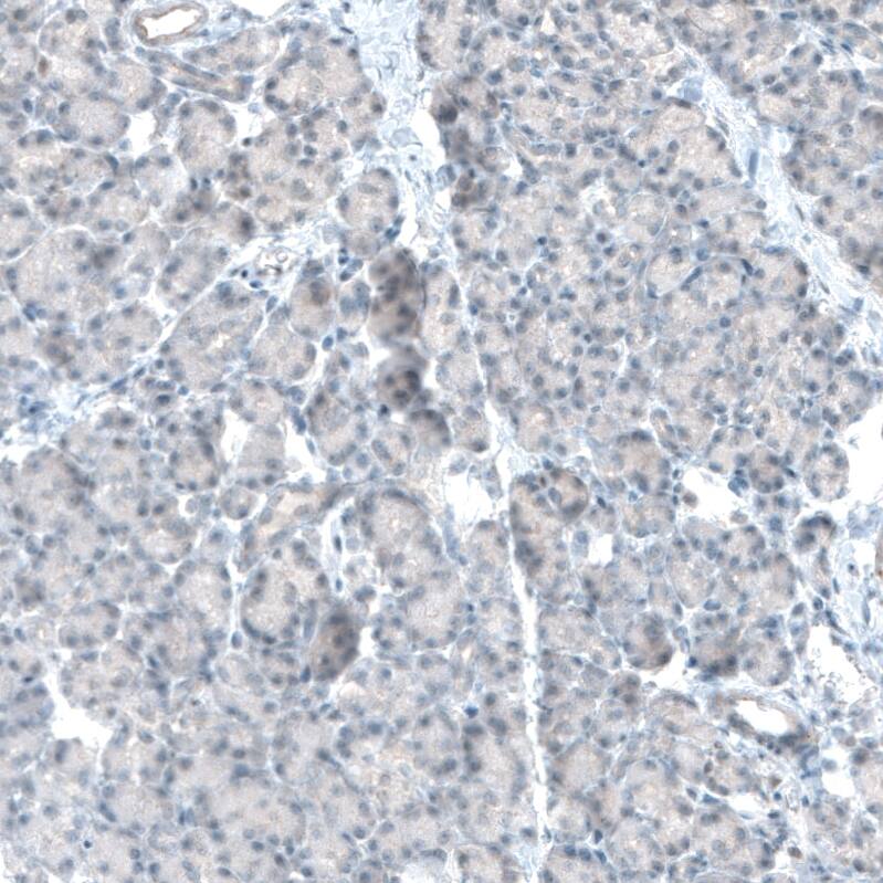 TET2 Antibody (CL6873) - Azide and BSA Free Immunohistochemistry-Paraffin: TET2 Antibody [NBP3-44224]