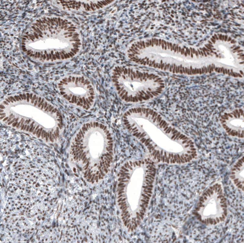 HYPB Antibody (CL9956) - Azide and BSA Free Immunohistochemistry-Paraffin: HYPB Antibody [NBP3-44227]