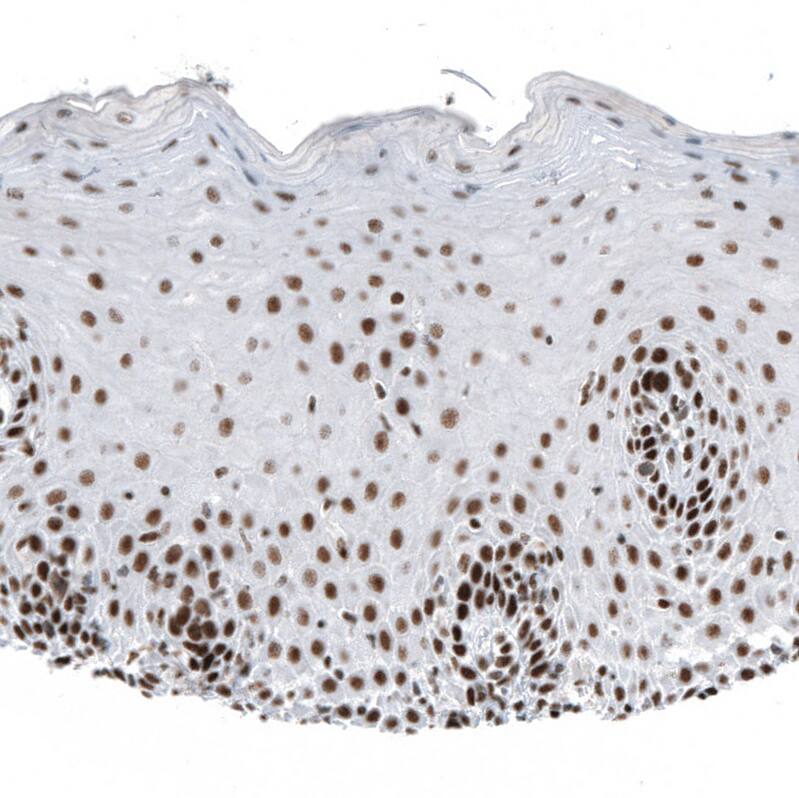 HYPB Antibody (CL9956) - Azide and BSA Free Immunohistochemistry-Paraffin: HYPB Antibody [NBP3-44227]