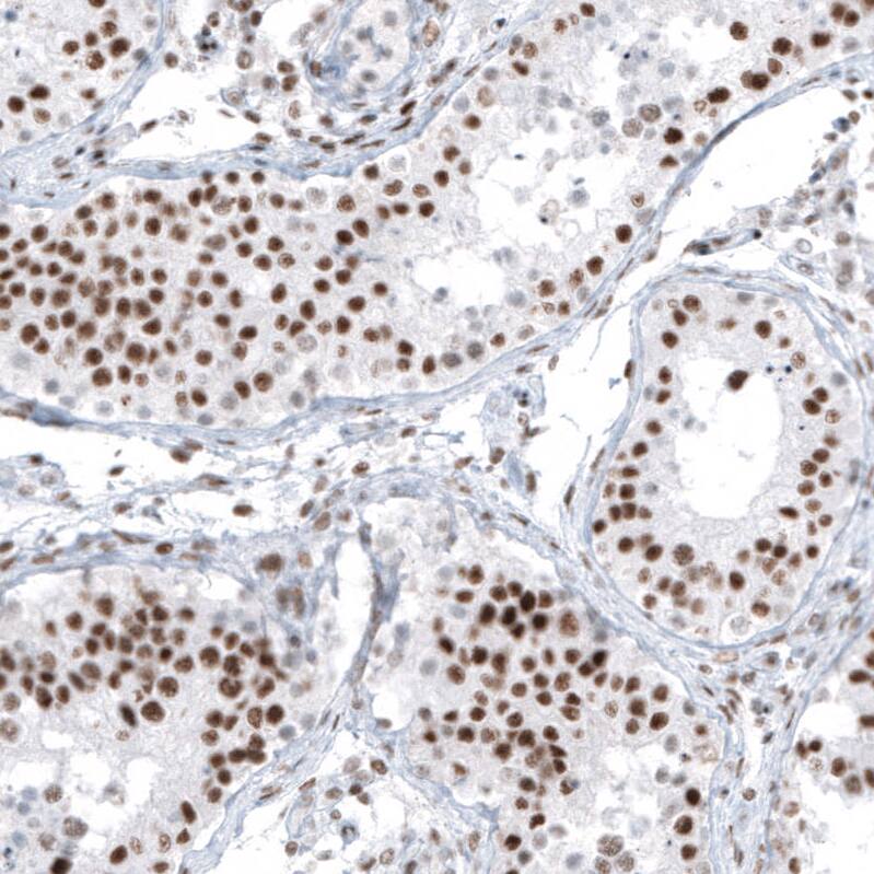 HYPB Antibody (CL9956) - Azide and BSA Free Immunohistochemistry-Paraffin: HYPB Antibody [NBP3-44227]