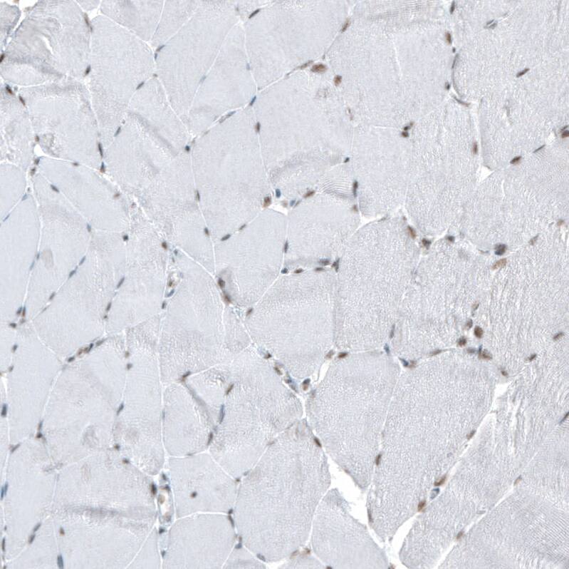 HYPB Antibody (CL9956) - Azide and BSA Free Immunohistochemistry-Paraffin: HYPB Antibody [NBP3-44227]