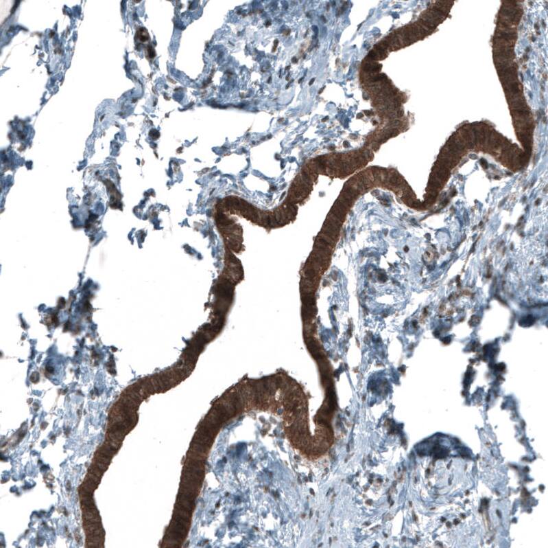 Smad2 Antibody (CL8472) - Azide and BSA Free Immunohistochemistry-Paraffin: Smad2 Antibody [NBP3-44228]
