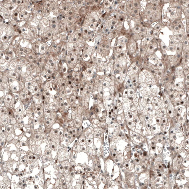 SF-1/NR5A1/Steroidogenic Factor 1 Antibody (CL9101) - Azide and BSA Free Immunohistochemistry-Paraffin: SF-1/NR5A1/Steroidogenic Factor 1 Antibody [NBP3-44229]