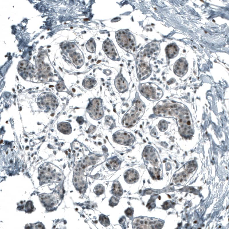 SF-1/NR5A1/Steroidogenic Factor 1 Antibody (CL9101) - Azide and BSA Free Immunohistochemistry-Paraffin: SF-1/NR5A1/Steroidogenic Factor 1 Antibody [NBP3-44229]