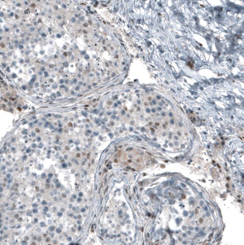 SF-1/NR5A1/Steroidogenic Factor 1 Antibody (CL9101) - Azide and BSA Free Immunohistochemistry-Paraffin: SF-1/NR5A1/Steroidogenic Factor 1 Antibody [NBP3-44229]