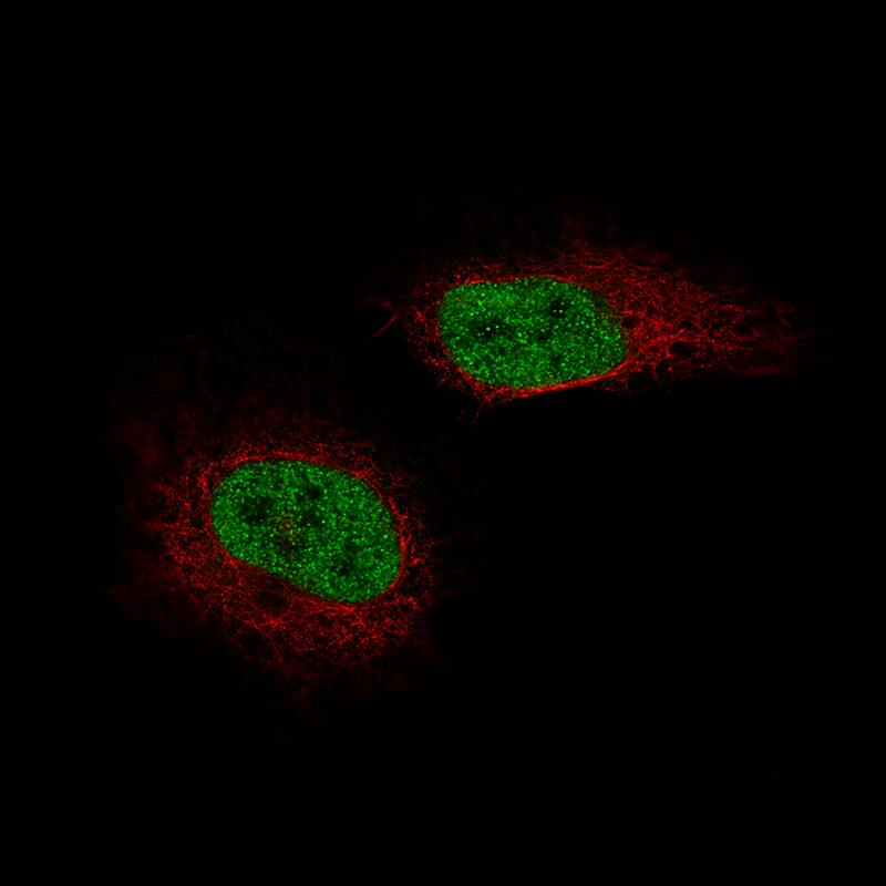 SF-1/NR5A1/Steroidogenic Factor 1 Antibody (CL9101) - Azide and BSA Free Immunocytochemistry/ Immunofluorescence: SF-1/NR5A1/Steroidogenic Factor 1 Antibody [NBP3-44229]