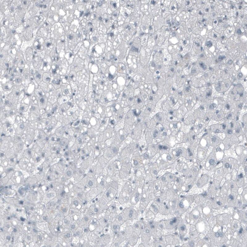 FGF18 Antibody (CL7628) - Azide and BSA Free Immunohistochemistry-Paraffin: FGF18 Antibody [NBP3-44231]