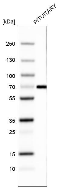 ZNF10 Antibody (CL9744) - Azide and BSA Free Western Blot: ZNF10 Antibody [NBP3-44232]