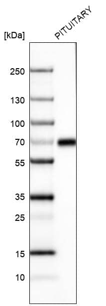 ZNF10 Antibody (CL9747) - Azide and BSA Free Western Blot: ZNF10 Antibody [NBP3-44233]