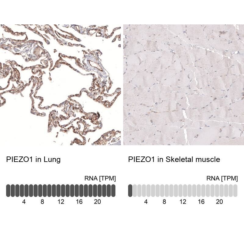 PIEZO1 Antibody (CL9714) - Azide and BSA Free Immunohistochemistry-Paraffin: PIEZO1 Antibody [NBP3-44234]