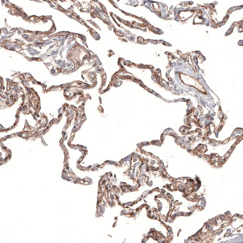 PIEZO1 Antibody (CL9714) - Azide and BSA Free Immunohistochemistry-Paraffin: PIEZO1 Antibody [NBP3-44234]