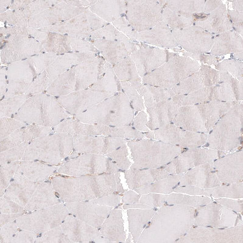 PIEZO1 Antibody (CL9714) - Azide and BSA Free Immunohistochemistry-Paraffin: PIEZO1 Antibody [NBP3-44234]