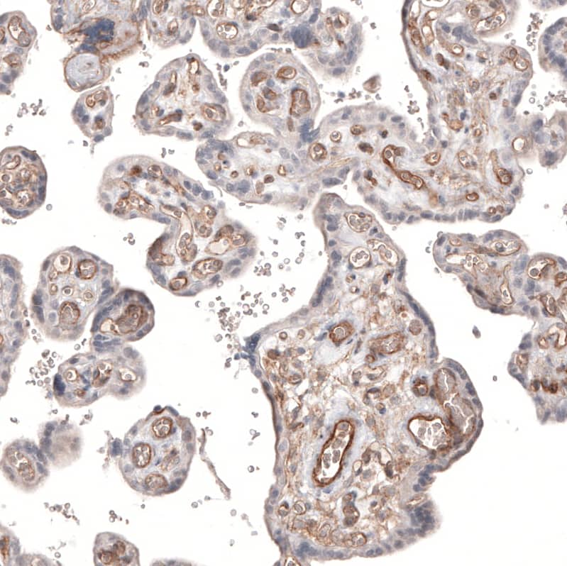 PIEZO1 Antibody (CL9714) - Azide and BSA Free Immunohistochemistry-Paraffin: PIEZO1 Antibody [NBP3-44234]