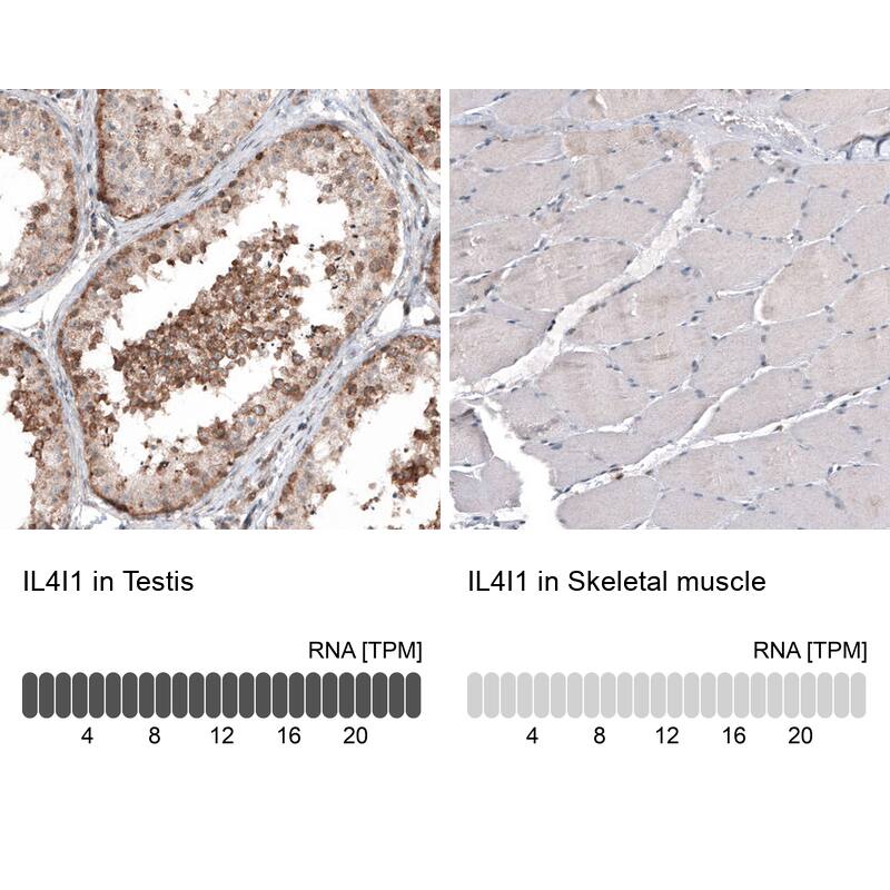 IL-4I1 Antibody (CL9071) - Azide and BSA Free Immunohistochemistry-Paraffin: IL-4I1 Antibody [NBP3-44235]
