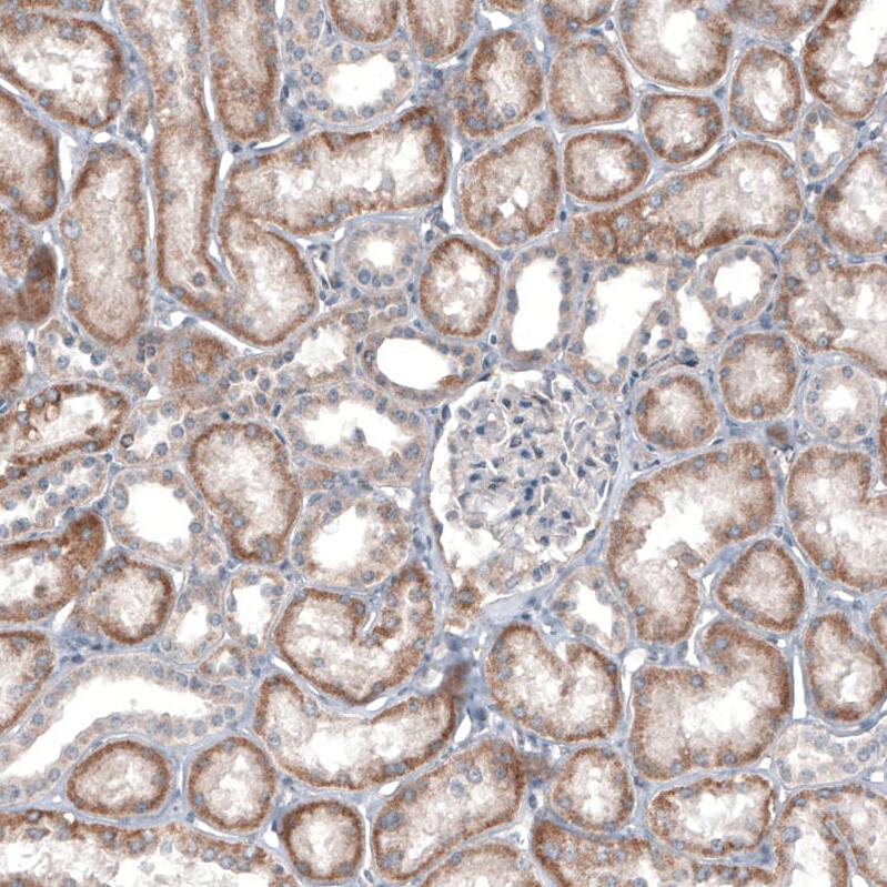 IL-4I1 Antibody (CL9071) - Azide and BSA Free Immunohistochemistry-Paraffin: IL-4I1 Antibody [NBP3-44235]