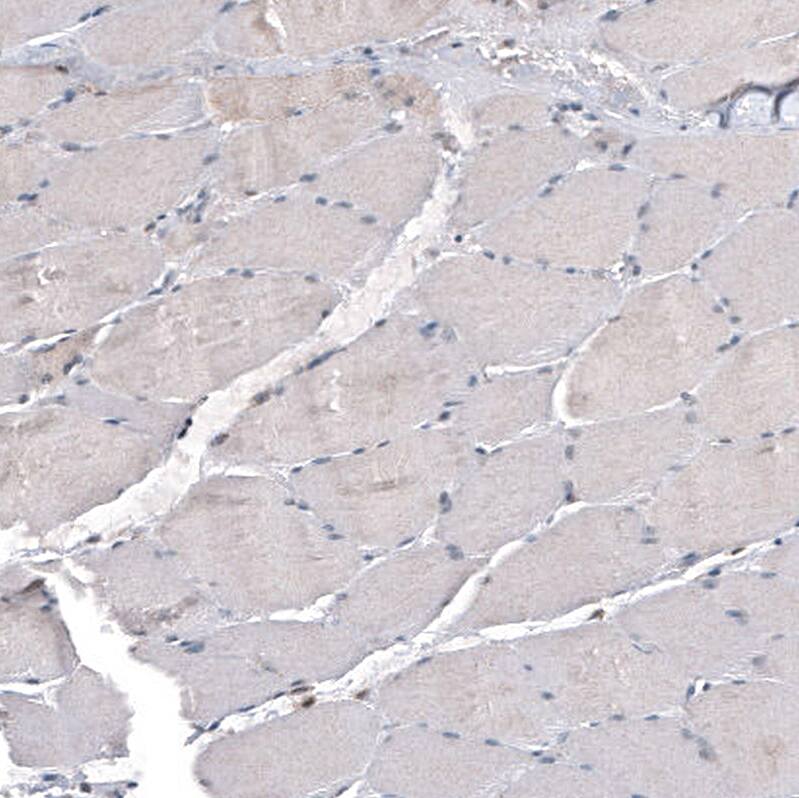 IL-4I1 Antibody (CL9071) - Azide and BSA Free Immunohistochemistry-Paraffin: IL-4I1 Antibody [NBP3-44235]