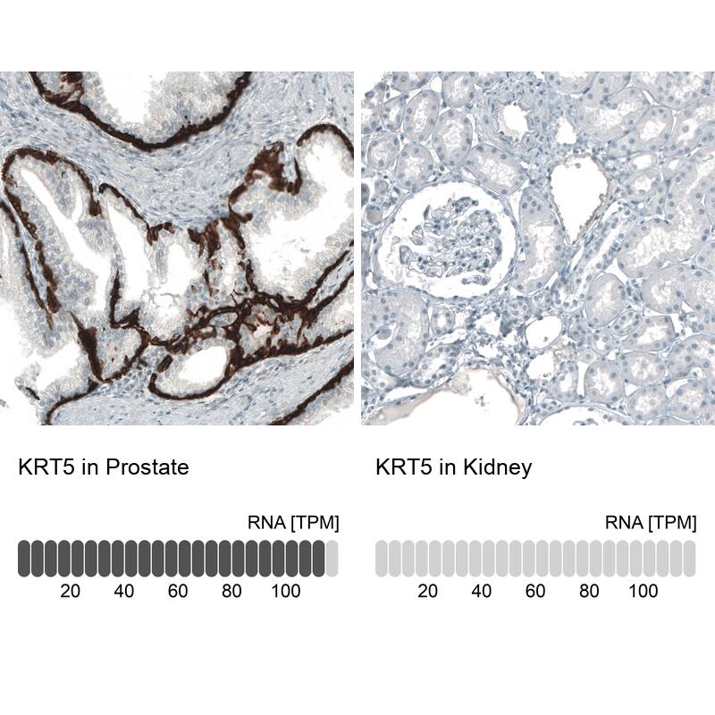 Cytokeratin 5 Antibody (CL9297) - Azide and BSA Free Immunohistochemistry-Paraffin: Cytokeratin 5 Antibody [NBP3-44236]