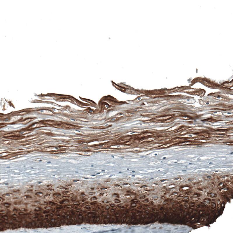 Cytokeratin 5 Antibody (CL9297) - Azide and BSA Free Immunohistochemistry-Paraffin: Cytokeratin 5 Antibody [NBP3-44236]