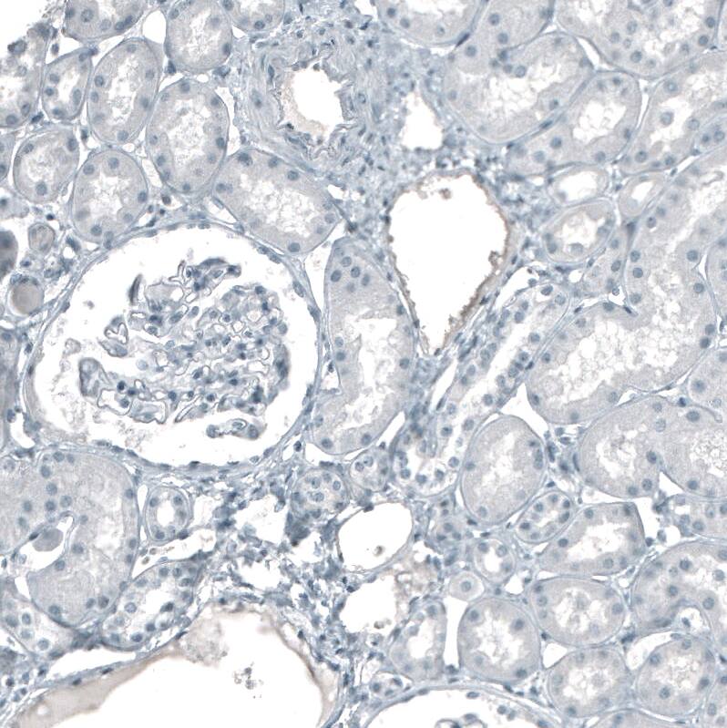 Cytokeratin 5 Antibody (CL9297) - Azide and BSA Free Immunohistochemistry-Paraffin: Cytokeratin 5 Antibody [NBP3-44236]