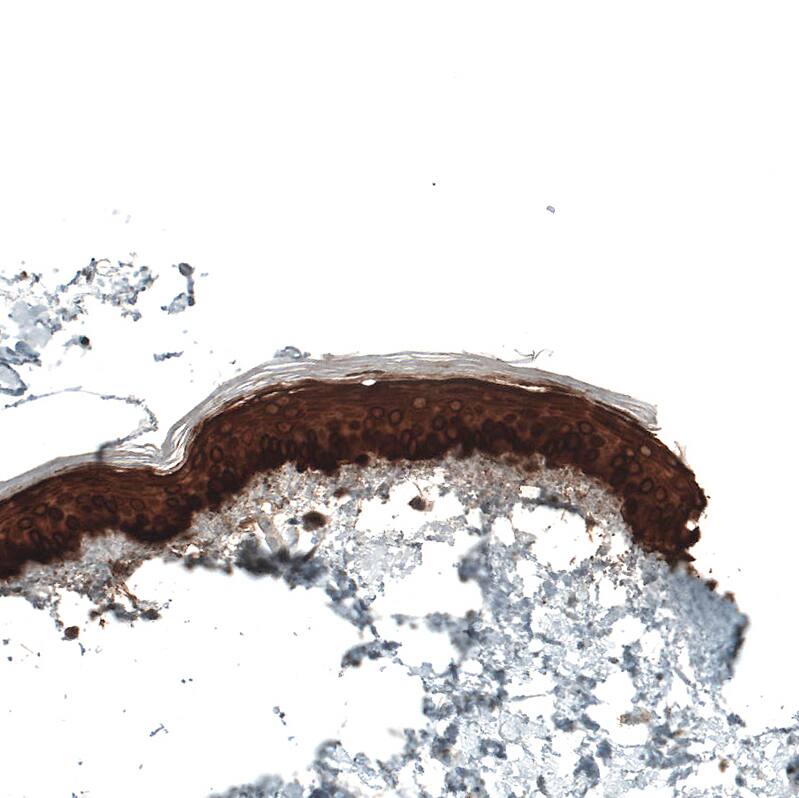 Cytokeratin 5 Antibody (CL9297) - Azide and BSA Free Immunohistochemistry-Paraffin: Cytokeratin 5 Antibody [NBP3-44236]