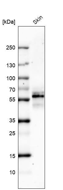 Cytokeratin 5 Antibody (CL9297) - Azide and BSA Free Western Blot: Cytokeratin 5 Antibody [NBP3-44236]