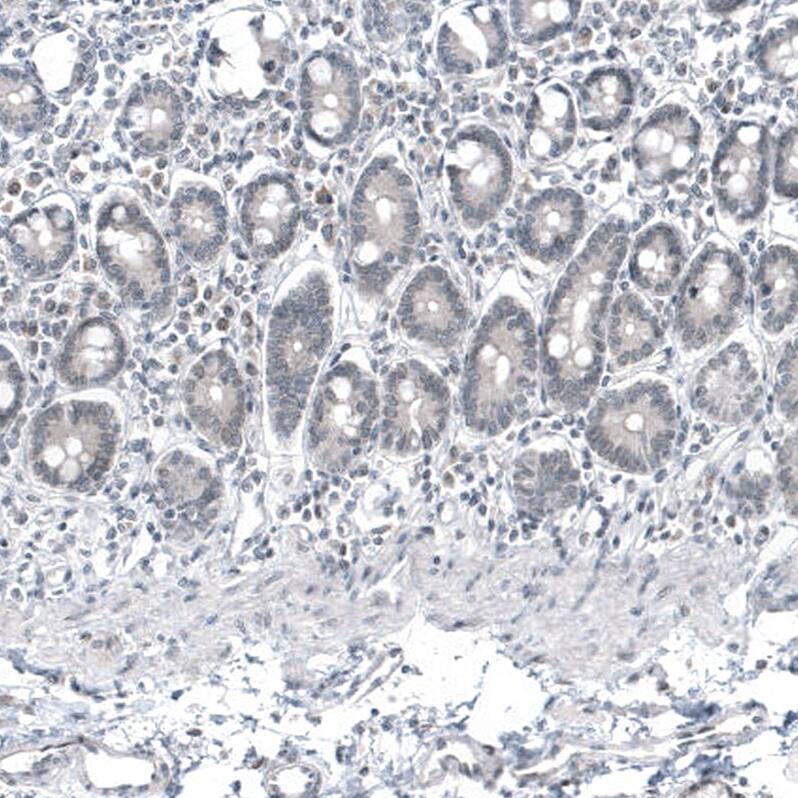 Mammaglobin A Antibody (CL8892) - Azide and BSA Free Immunohistochemistry-Paraffin: Mammaglobin A Antibody [NBP3-44237]