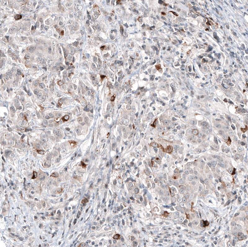 Mammaglobin A Antibody (CL8892) - Azide and BSA Free Immunohistochemistry-Paraffin: Mammaglobin A Antibody [NBP3-44237]