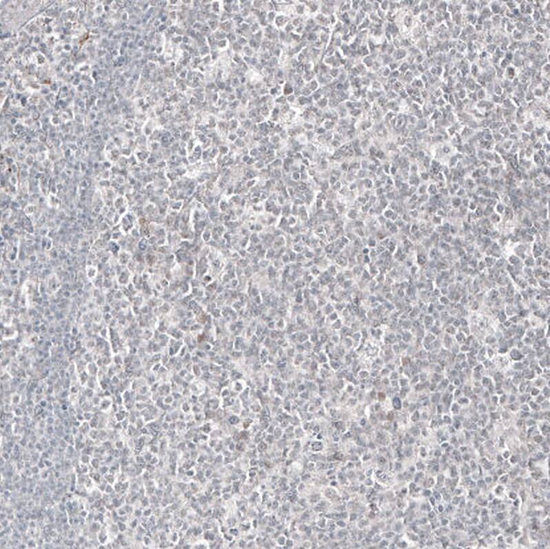 Mammaglobin A Antibody (CL8892) - Azide and BSA Free Immunohistochemistry-Paraffin: Mammaglobin A Antibody [NBP3-44237]