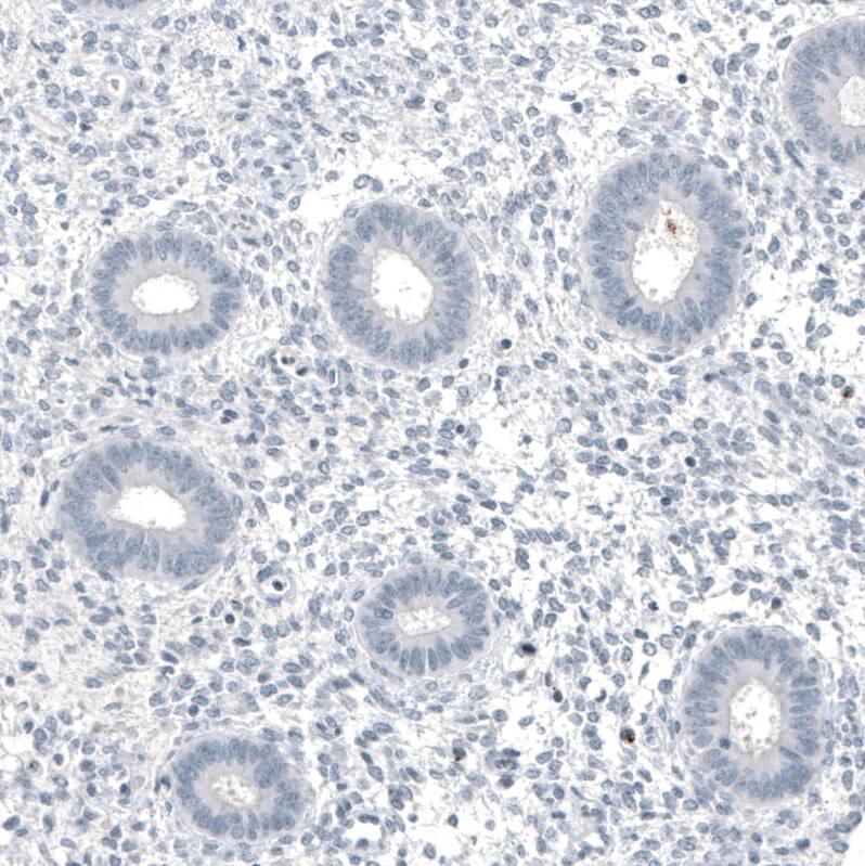 MUC5AC Antibody (CL8961) - Azide and BSA Free Immunohistochemistry-Paraffin: MUC5AC Antibody [NBP3-44238]