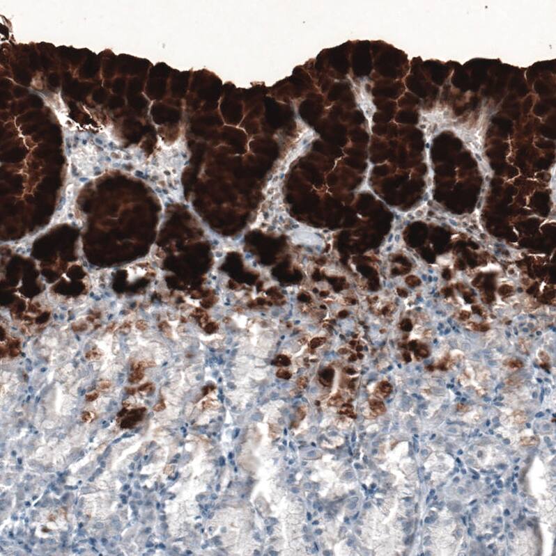 MUC5AC Antibody (CL8961) - Azide and BSA Free Immunohistochemistry-Paraffin: MUC5AC Antibody [NBP3-44238]