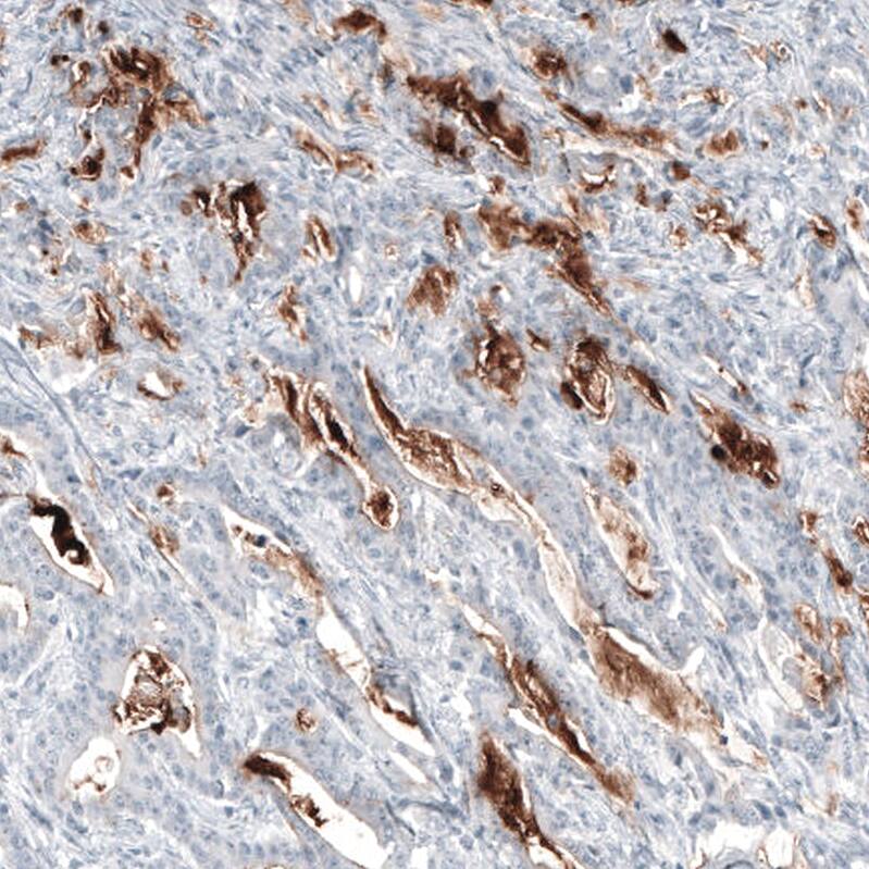 MUC5AC Antibody (CL8961) - Azide and BSA Free Immunohistochemistry-Paraffin: MUC5AC Antibody [NBP3-44238]