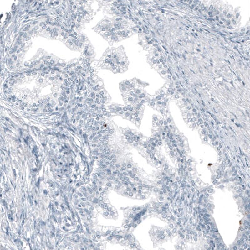 MUC5AC Antibody (CL8961) - Azide and BSA Free Immunohistochemistry-Paraffin: MUC5AC Antibody [NBP3-44238]