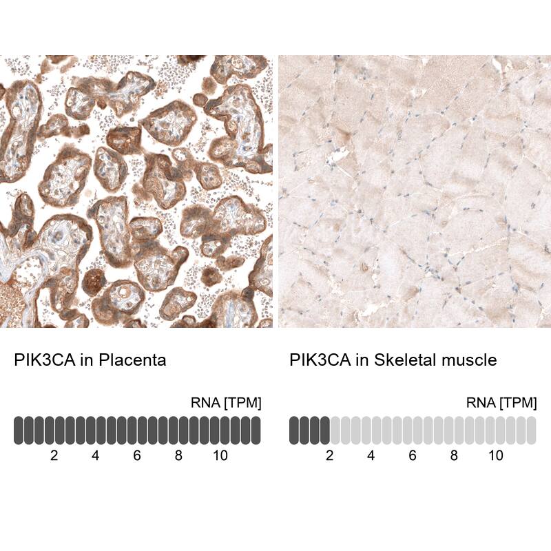 PIK3CA Antibody (CL8347) - Azide and BSA Free Immunohistochemistry-Paraffin: PIK3CA Antibody [NBP3-44239]