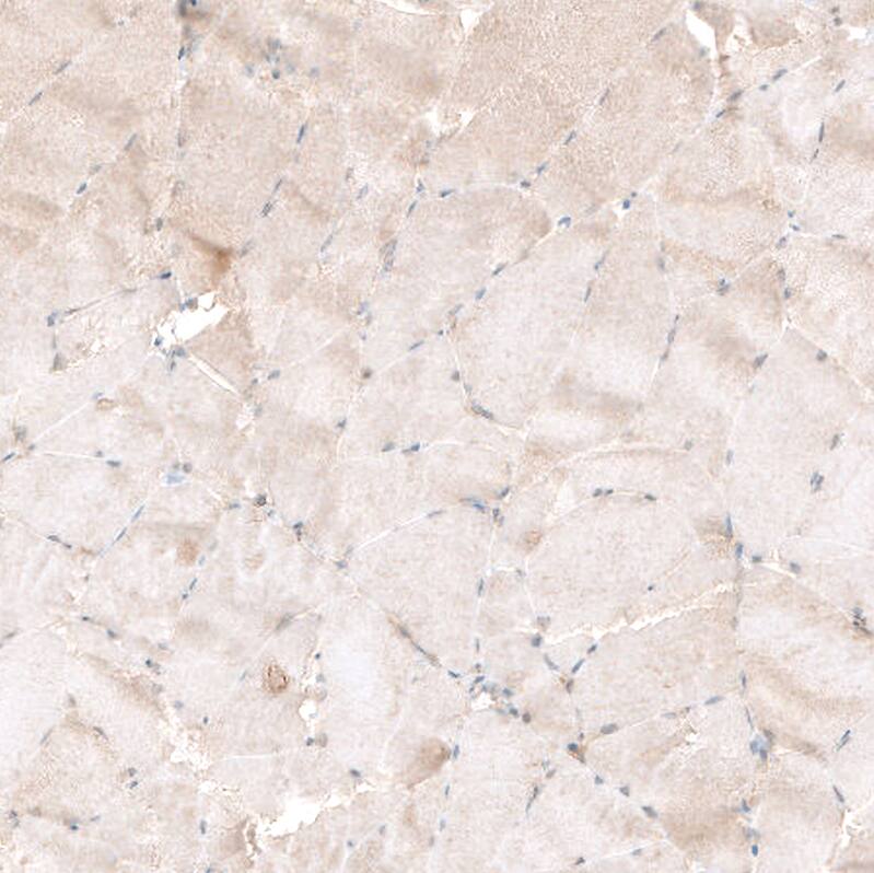 PIK3CA Antibody (CL8347) - Azide and BSA Free Immunohistochemistry-Paraffin: PIK3CA Antibody [NBP3-44239]