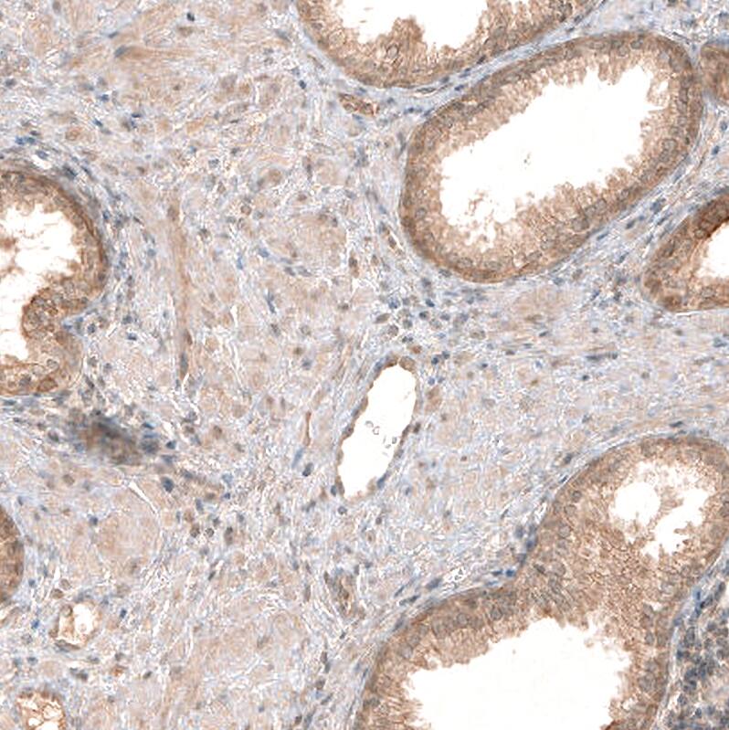 PIK3CA Antibody (CL8347) - Azide and BSA Free Immunohistochemistry-Paraffin: PIK3CA Antibody [NBP3-44239]