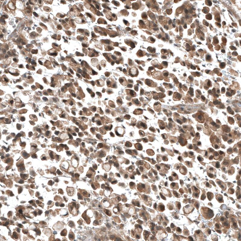 PIK3CA Antibody (CL8347) - Azide and BSA Free Immunohistochemistry-Paraffin: PIK3CA Antibody [NBP3-44239]