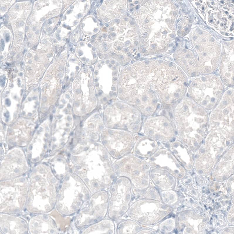 CXCL13/BLC/BCA-1 Antibody (CL10543) - Azide and BSA Free Immunohistochemistry-Paraffin: CXCL13/BLC/BCA-1 Antibody [NBP3-44241]