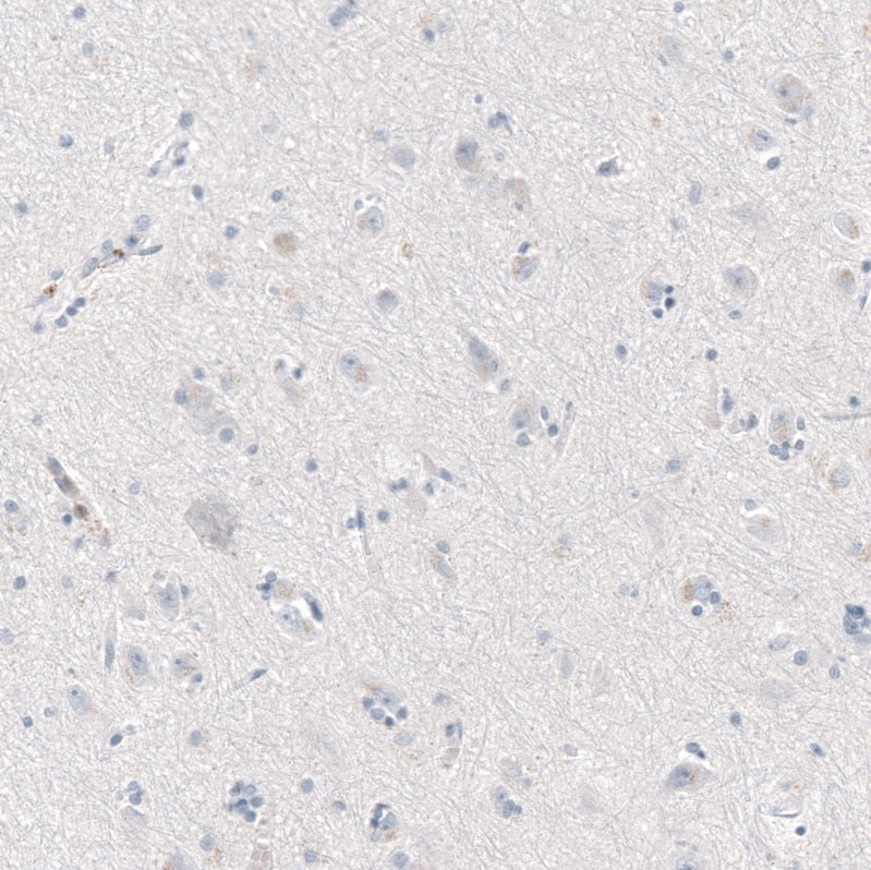 CXCL13/BLC/BCA-1 Antibody (CL10543) - Azide and BSA Free Immunohistochemistry-Paraffin: CXCL13/BLC/BCA-1 Antibody [NBP3-44241]