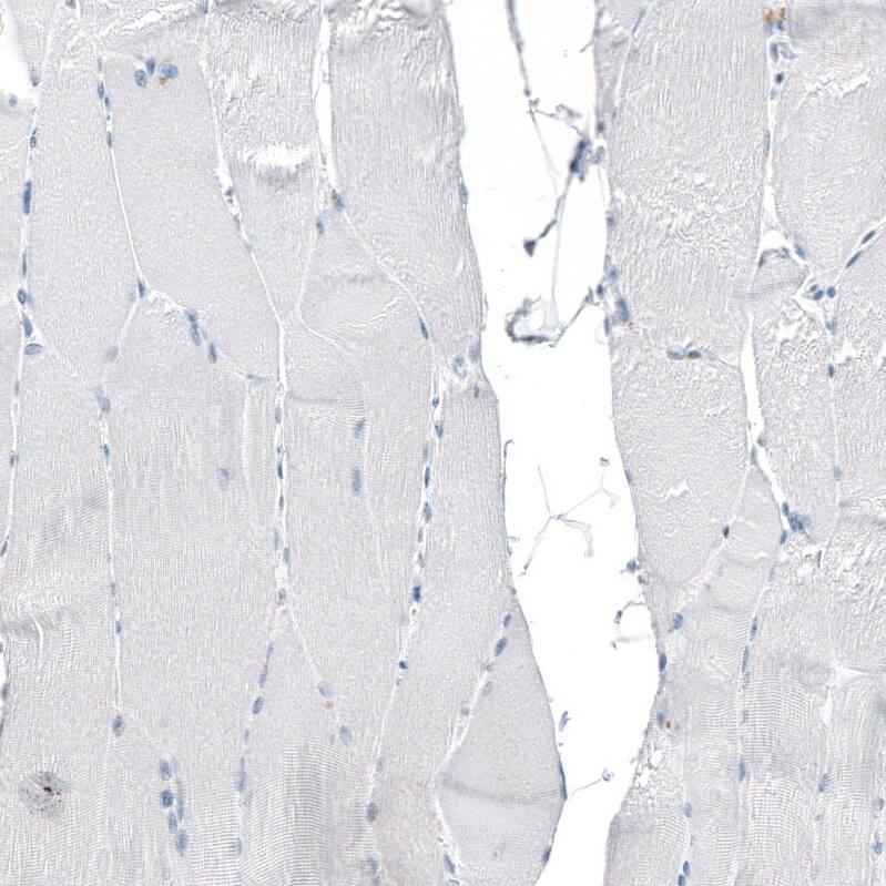 CXCL13/BLC/BCA-1 Antibody (CL10543) - Azide and BSA Free Immunohistochemistry-Paraffin: CXCL13/BLC/BCA-1 Antibody [NBP3-44241]