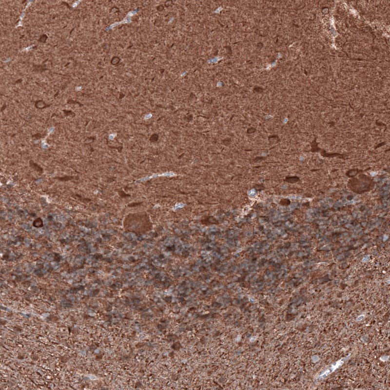beta-III Tubulin Antibody (CL5813) - Azide and BSA Free Immunohistochemistry-Paraffin: beta-III Tubulin Antibody [NBP3-44243]