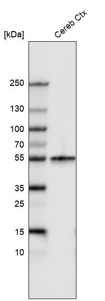 beta-III Tubulin Antibody (CL5813) - Azide and BSA Free Western Blot: beta-III Tubulin Antibody [NBP3-44243]