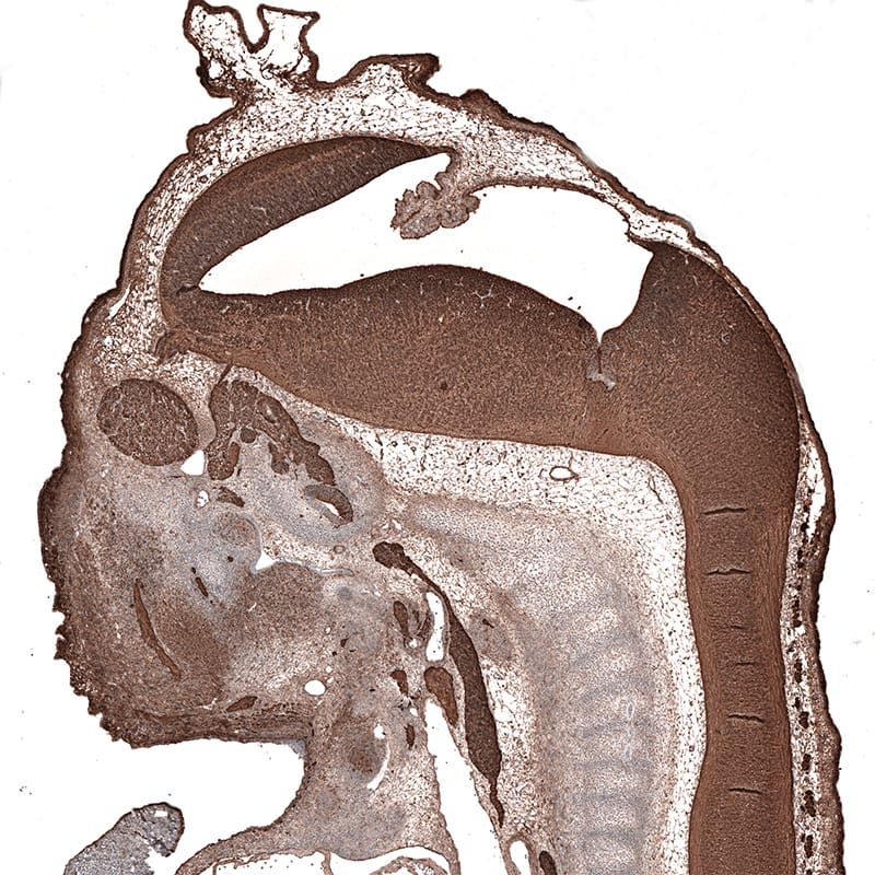 beta-III Tubulin Antibody (CL5813) - Azide and BSA Free Immunohistochemistry-Paraffin: beta-III Tubulin Antibody [NBP3-44243]