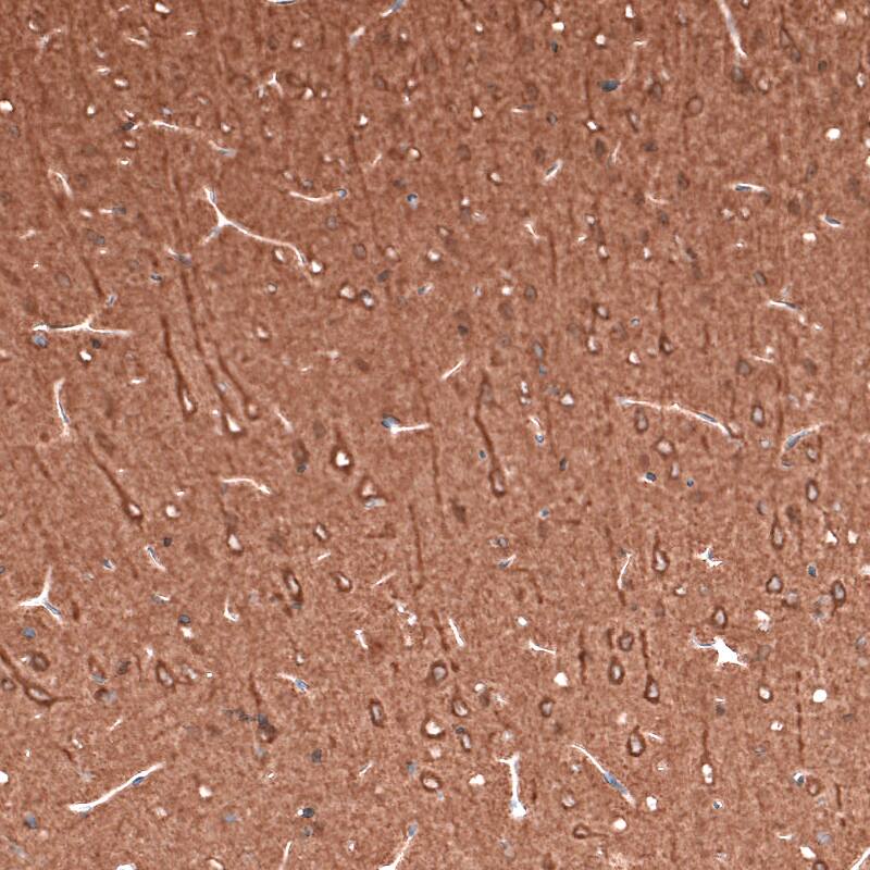 beta-III Tubulin Antibody (CL5813) - Azide and BSA Free Immunohistochemistry-Paraffin: beta-III Tubulin Antibody [NBP3-44243]