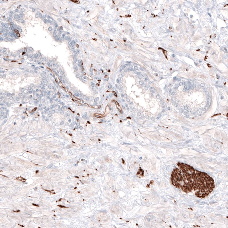 beta-III Tubulin Antibody (CL5813) - Azide and BSA Free Immunohistochemistry-Paraffin: beta-III Tubulin Antibody [NBP3-44243]