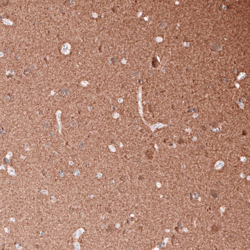 beta-III Tubulin Antibody (CL5814) - Azide and BSA Free Immunohistochemistry-Paraffin: beta-III Tubulin Antibody [NBP3-44244]
