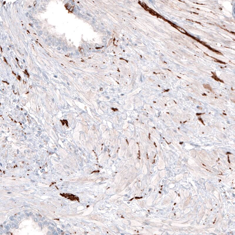 beta-III Tubulin Antibody (CL5814) - Azide and BSA Free Immunohistochemistry-Paraffin: beta-III Tubulin Antibody [NBP3-44244]