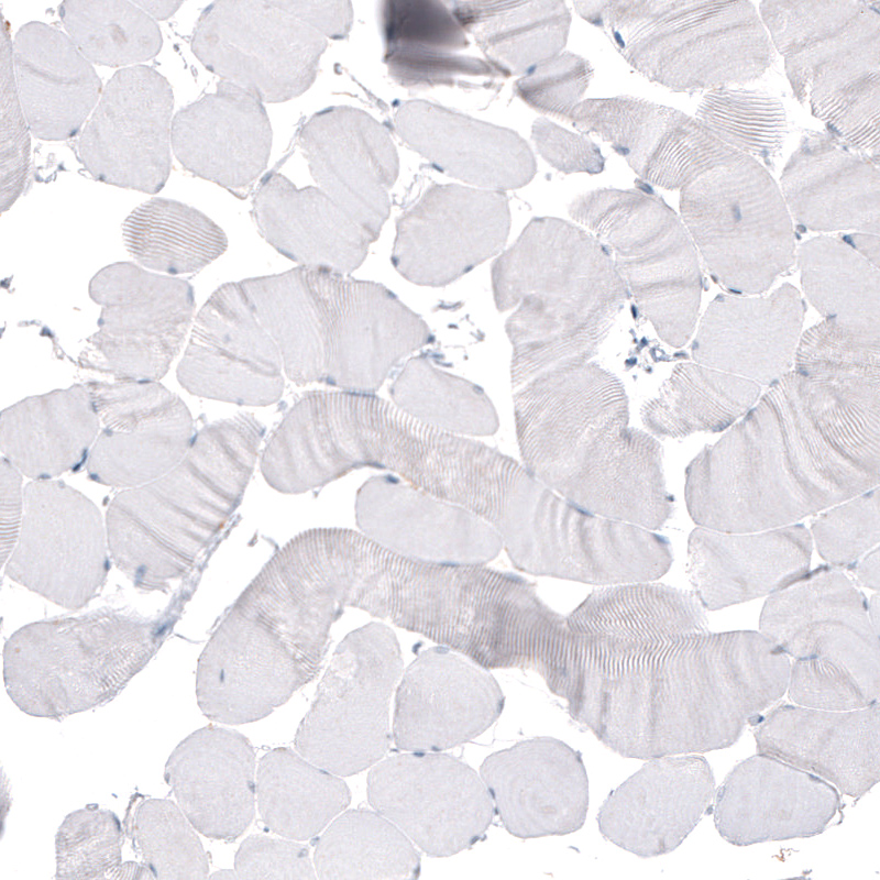 beta-III Tubulin Antibody (CL5814) - Azide and BSA Free Immunohistochemistry-Paraffin: beta-III Tubulin Antibody [NBP3-44244]