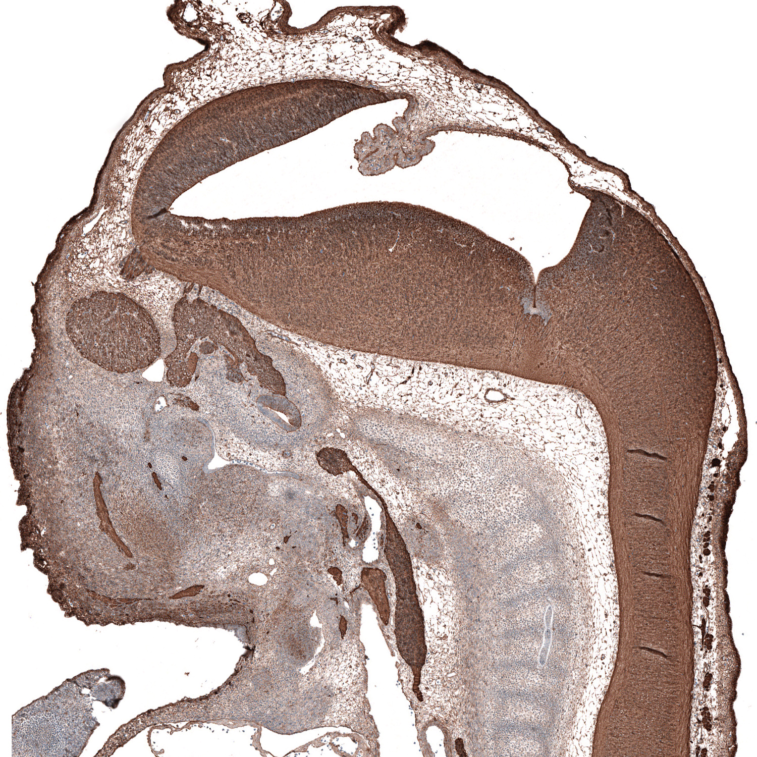 beta-III Tubulin Antibody (CL5814) - Azide and BSA Free Immunohistochemistry-Paraffin: beta-III Tubulin Antibody [NBP3-44244]
