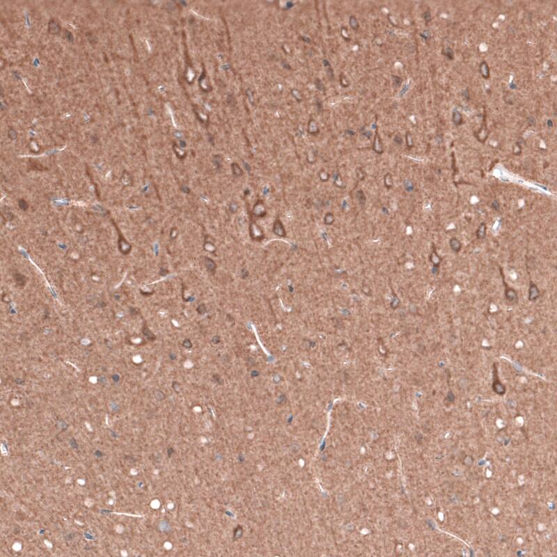 beta-III Tubulin Antibody (CL5814) - Azide and BSA Free Immunohistochemistry-Paraffin: beta-III Tubulin Antibody [NBP3-44244]